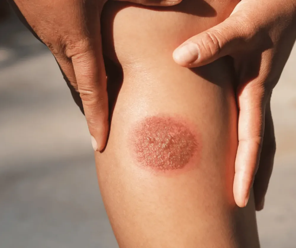 Road Rash