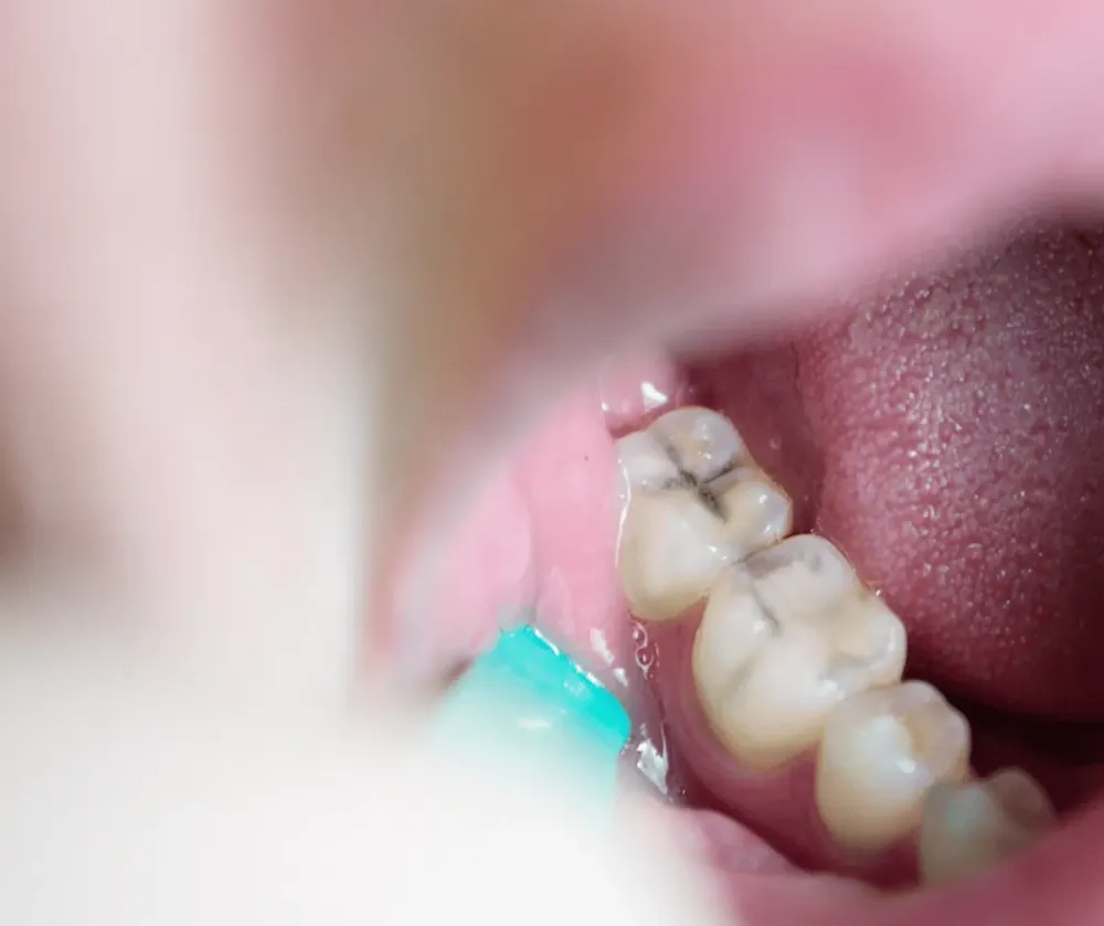 Dental