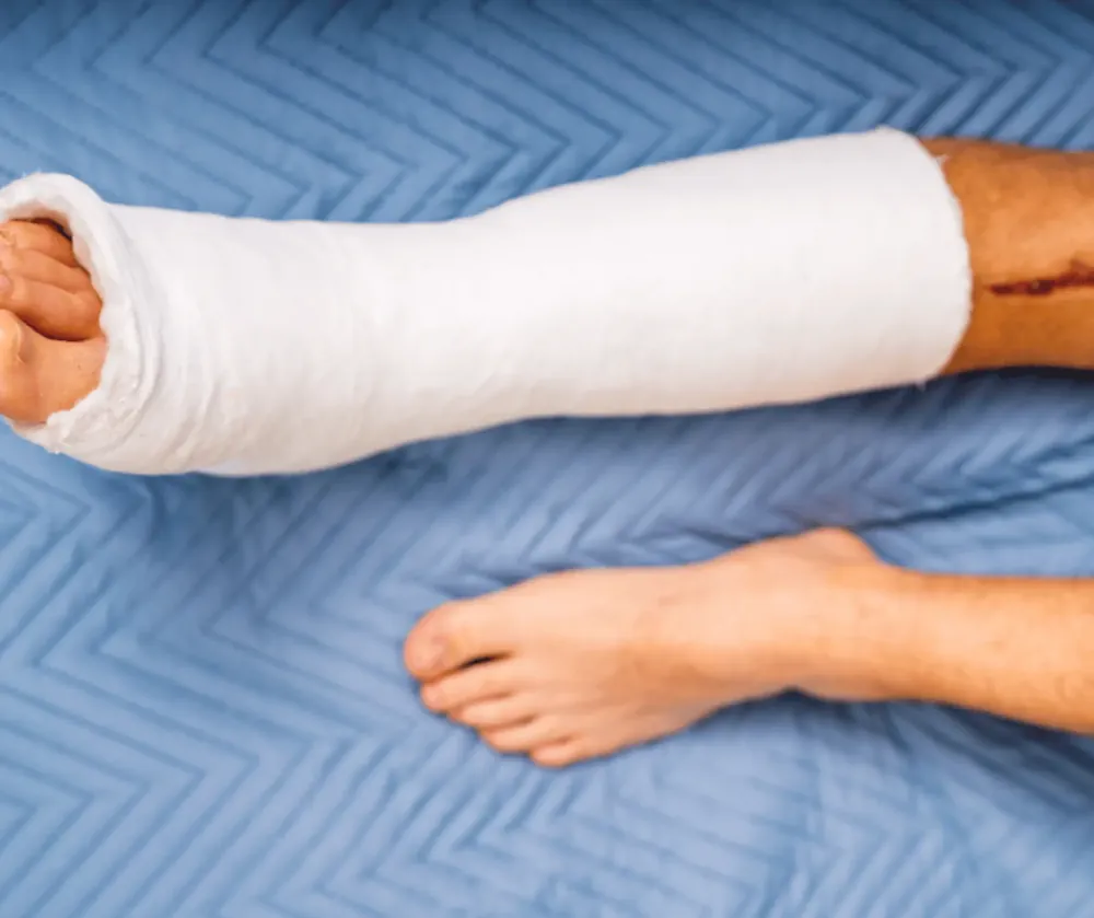 Ligament